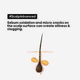 L’Oréal Professionnel Scalp Advanced Anti-Oiliness 2-In-1 Deep Purifier Clay | For Oily Scalp | With 3% AHA (250 Gm).